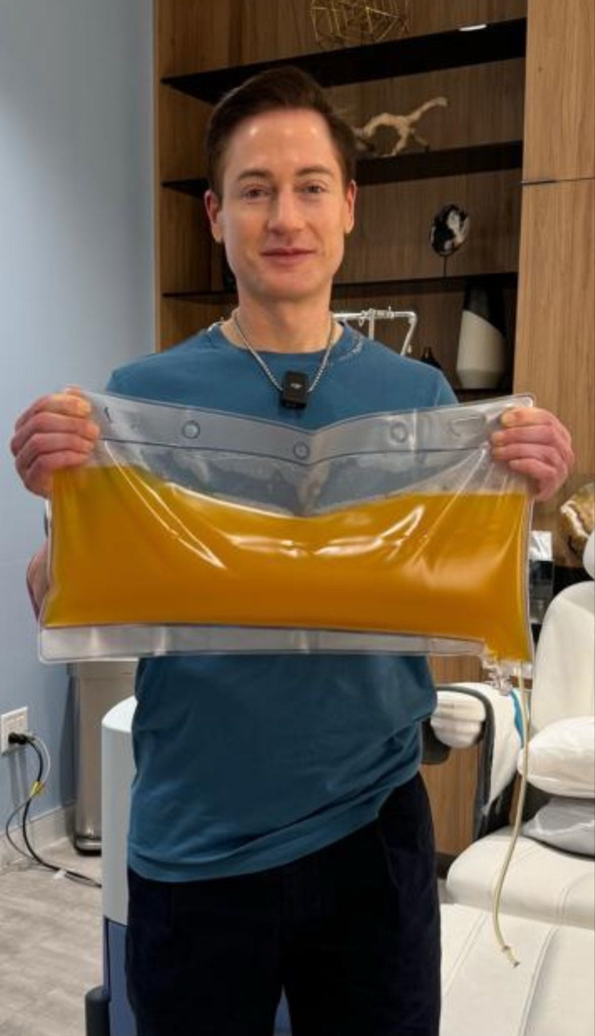 Bryan Johnson stands holding a large plastic bag with an attached tube filled with opaque yellow liquid