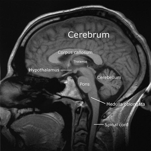 File:Labeledbrain-english.jpg