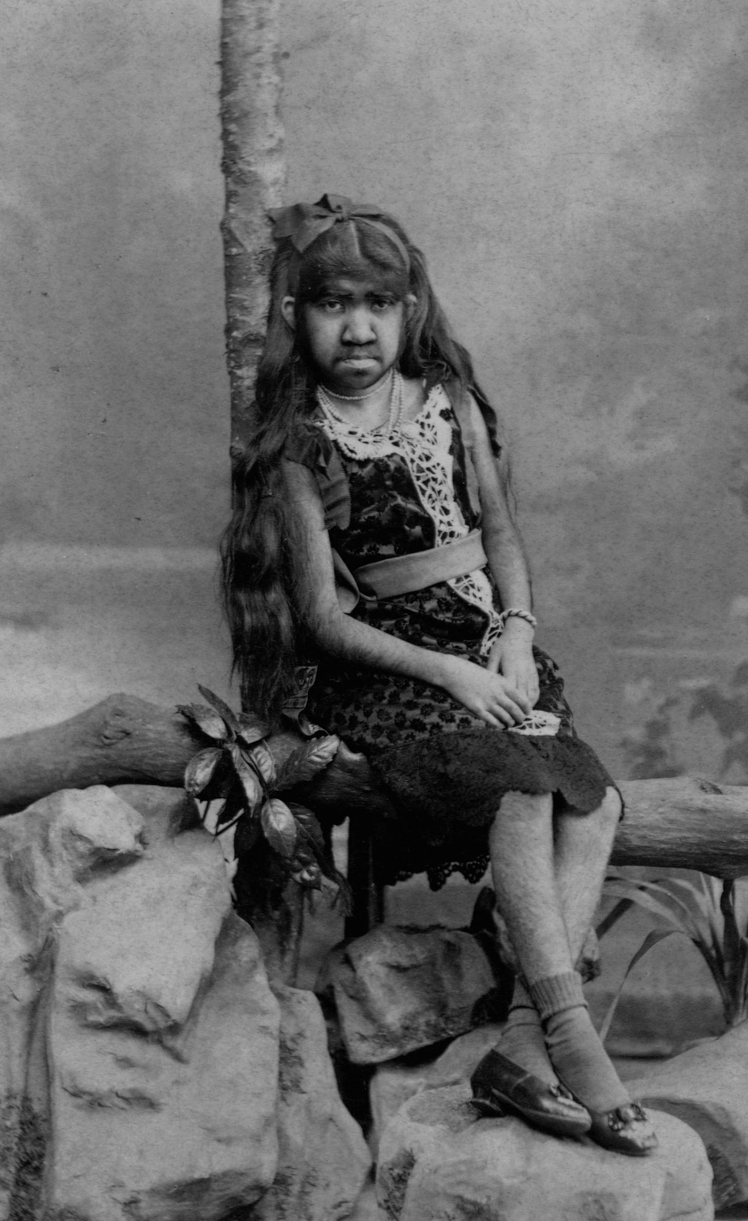  Krao Farini was an hirsute, flexibly jointed woman found in the Laotian jungle in 1885 and cruelly exhibited as 'the missing link'