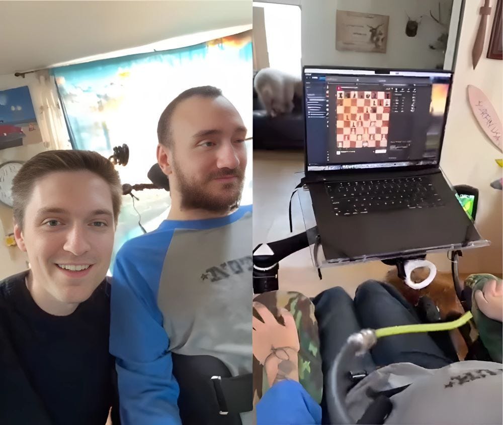 29-year-old quadriplegic, the first Neuralink user, plays chess online  using BCI - ChessBase India