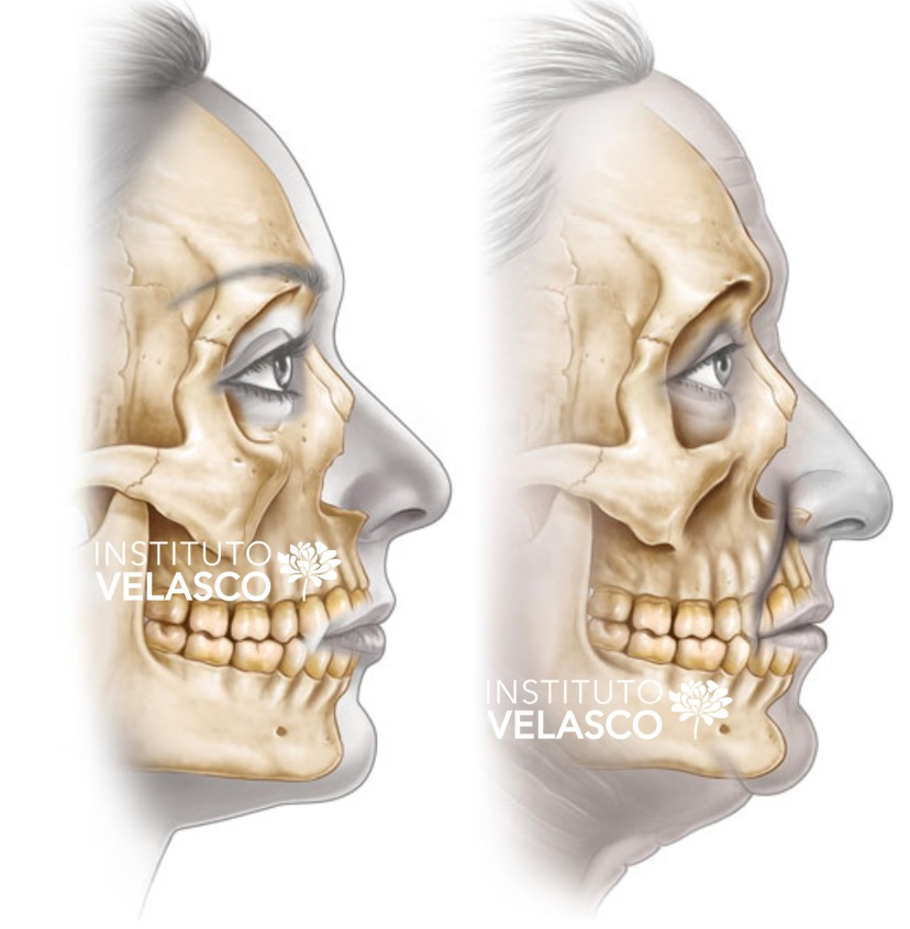 envelhecimento facial, harmonização facial
