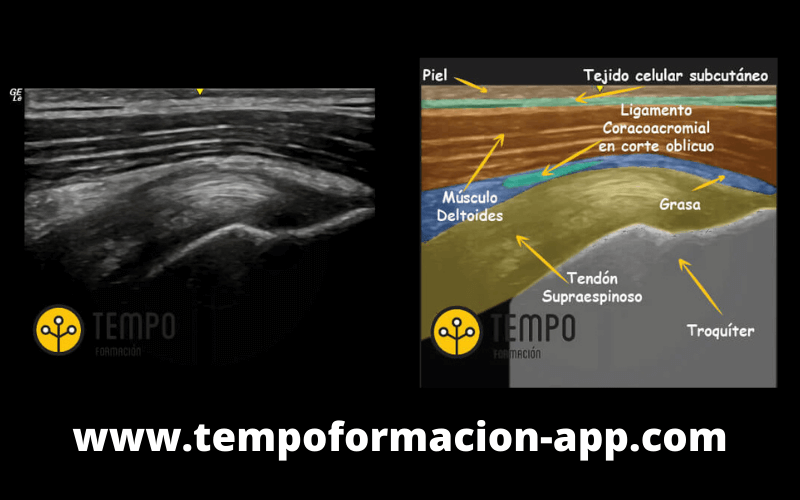 Supra Eco y Anatomía.png