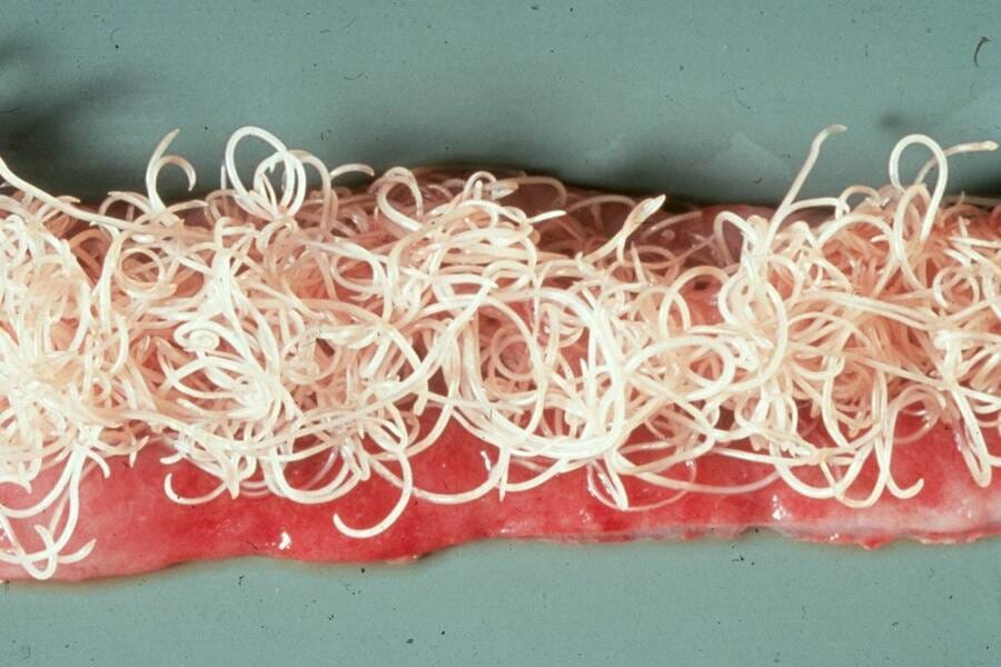 Roundworm-Infested Cat Gut