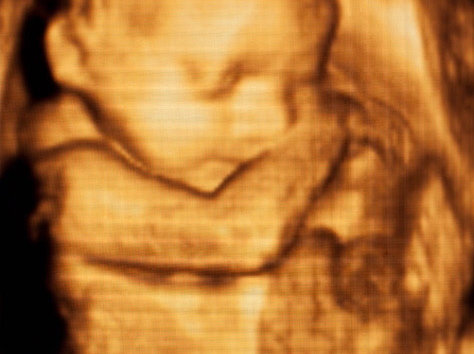 4-d ultrasound image of preborn baby 4-d ultrasound image of preborn baby