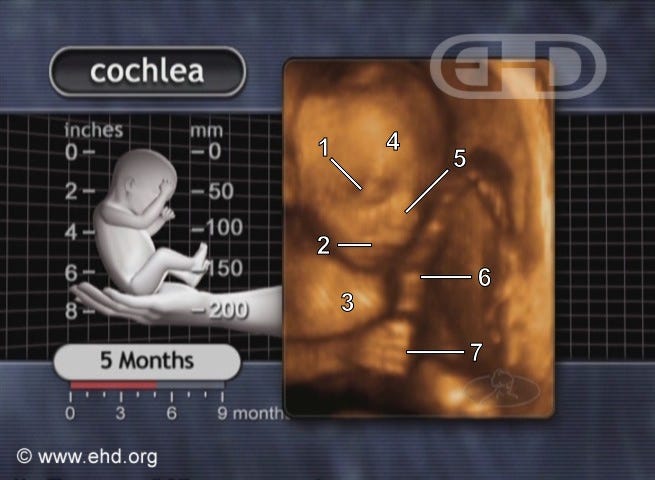 ultrasound and drawing of five month old preborn baby