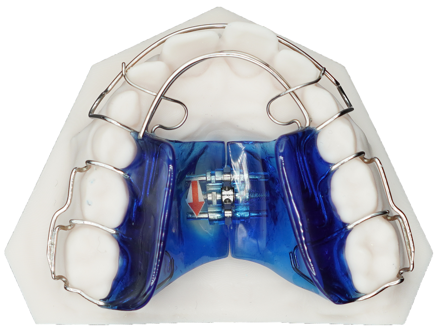 Bioblock Appliance - Protec Dental