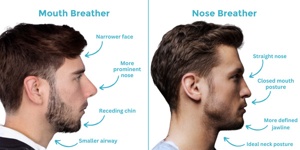 Mouth Breather vs. Nose Breathing | Diagram by Dryft Sleep | Dryft Sleep