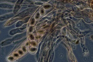 Morelasci spores