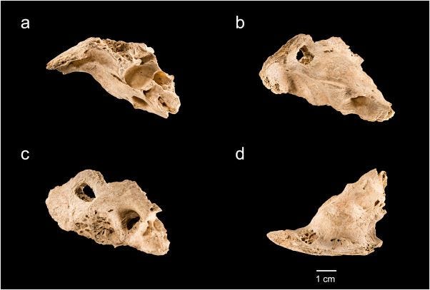 Temporal bone in four standard views