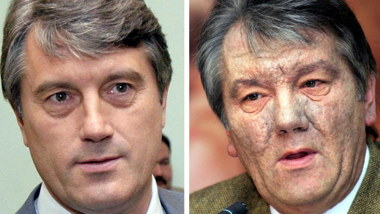 Former Ukrainian president Viktor Yushchenko before and after his dioxin poisoning. Picture: AFP