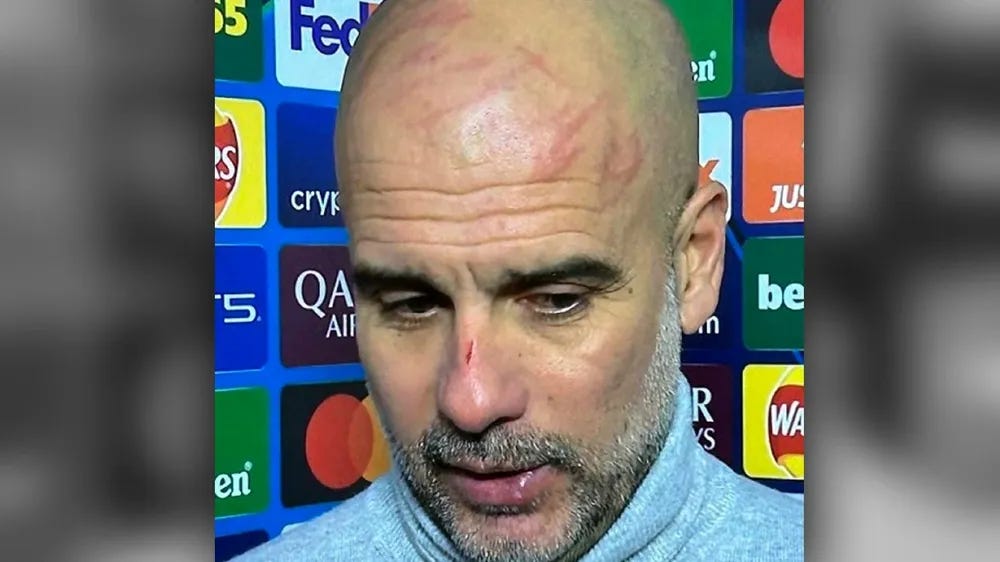 Qué le pasó a Pep Guardiola en la cara? Mirá las heridas que se le vieron  en conferencia de prensa y su explicación luego que le empataran un 3-0 al  City