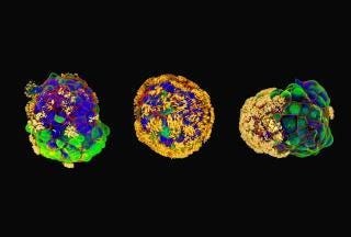 Three roundish objects made up of many colors, with short hair-like projections in yellow. Tiny biological multicellular bots called Anthrobots move around and help heal “wounds” created in cultured neurons