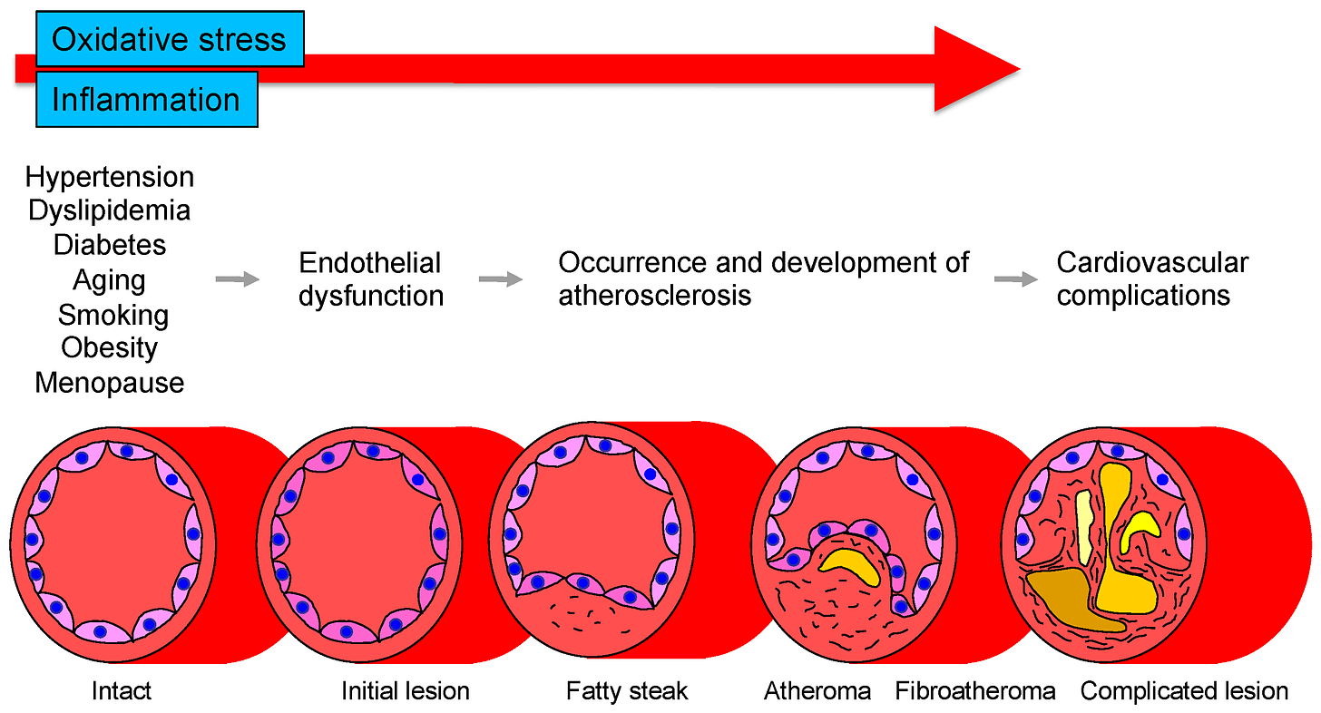 stages of cardiovascular disease starting with endothelial dysfunction 