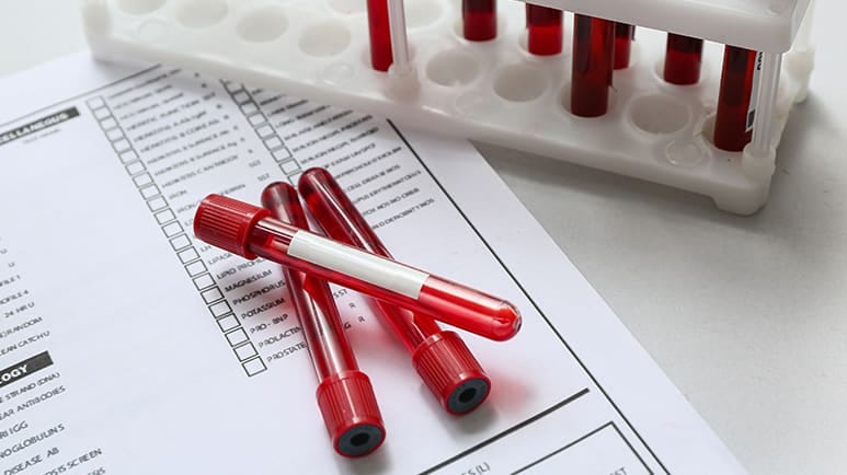 blood tests cardiovascular disease risks women