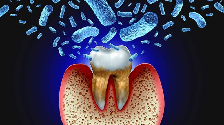 poor oral health wreaks havoc heart brain