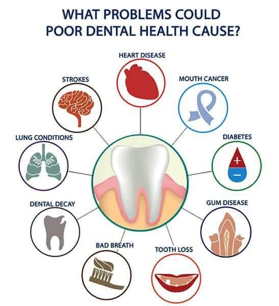 Oral Health Importance To Your Well-Being