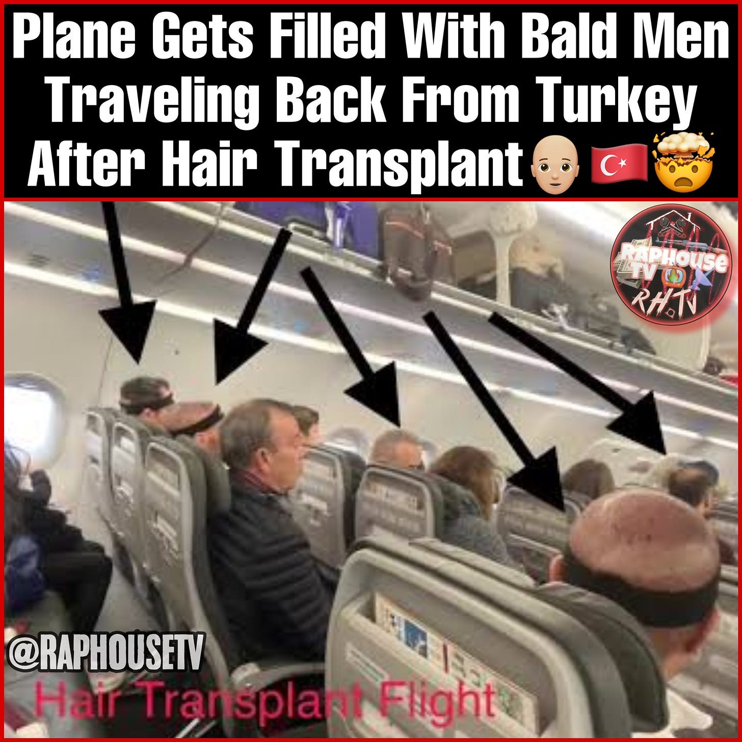 Raphousetv (RHTV) on X: "Plane Gets Filled With Bald Men Traveling Back  From Turkey After Hair Transplant🧑🏼‍🦲🇹🇷🤯 https://t.co/d8FIXSyln3" / X