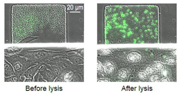 Kamikaze bacteria travel deep inside tumours to deliver deadly ...