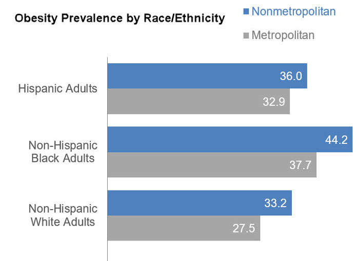 Obesity Prevalence by Race/Ethnicity