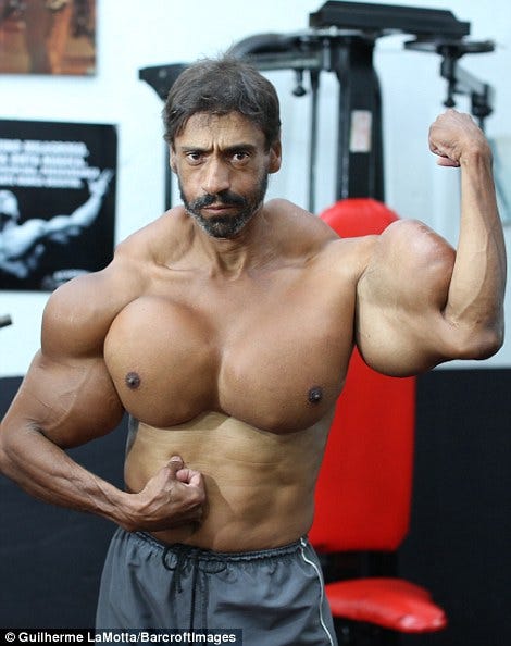 FOTO: Pria dengan Otot Bisep 58 Sentimeter Dijuluki 'Hulk', yang Ia ...