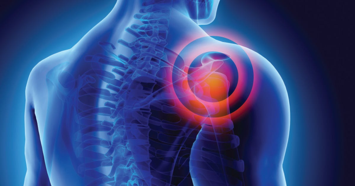 RACGP - Chronic shoulder pain