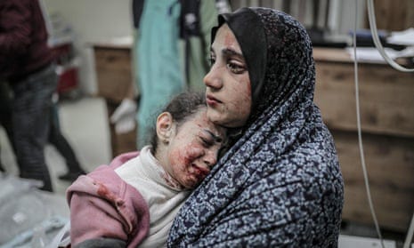 Egy palesztin anya és lánya megsérült egy izraeli támadásban pénteken a gázai Khan Younisben található Nasszer kórházban.