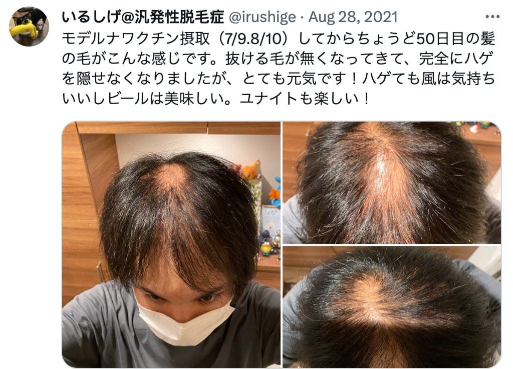 50th day after vaccination. (irushige/Twitter)