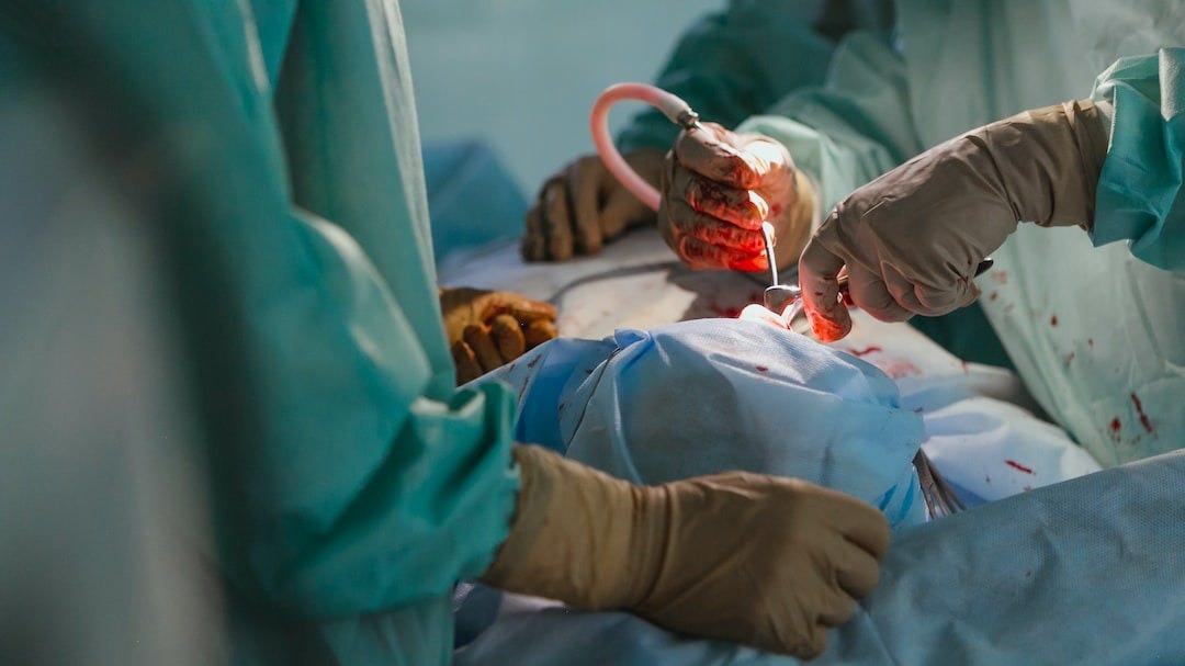 Groundbreaking Randomized Controlled Trial Reports Promising Results For Heart Transplant Patients