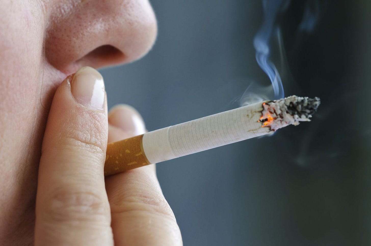 Dental Problems Associated With Smoking