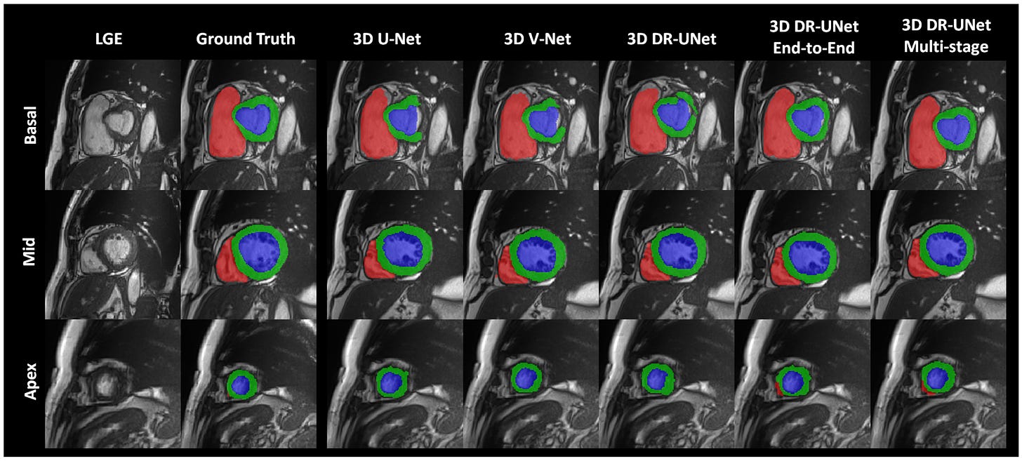 J. Imaging | Free Full-Text | Fully Automated 3D Cardiac MRI Localisation  and Segmentation Using Deep Neural Networks