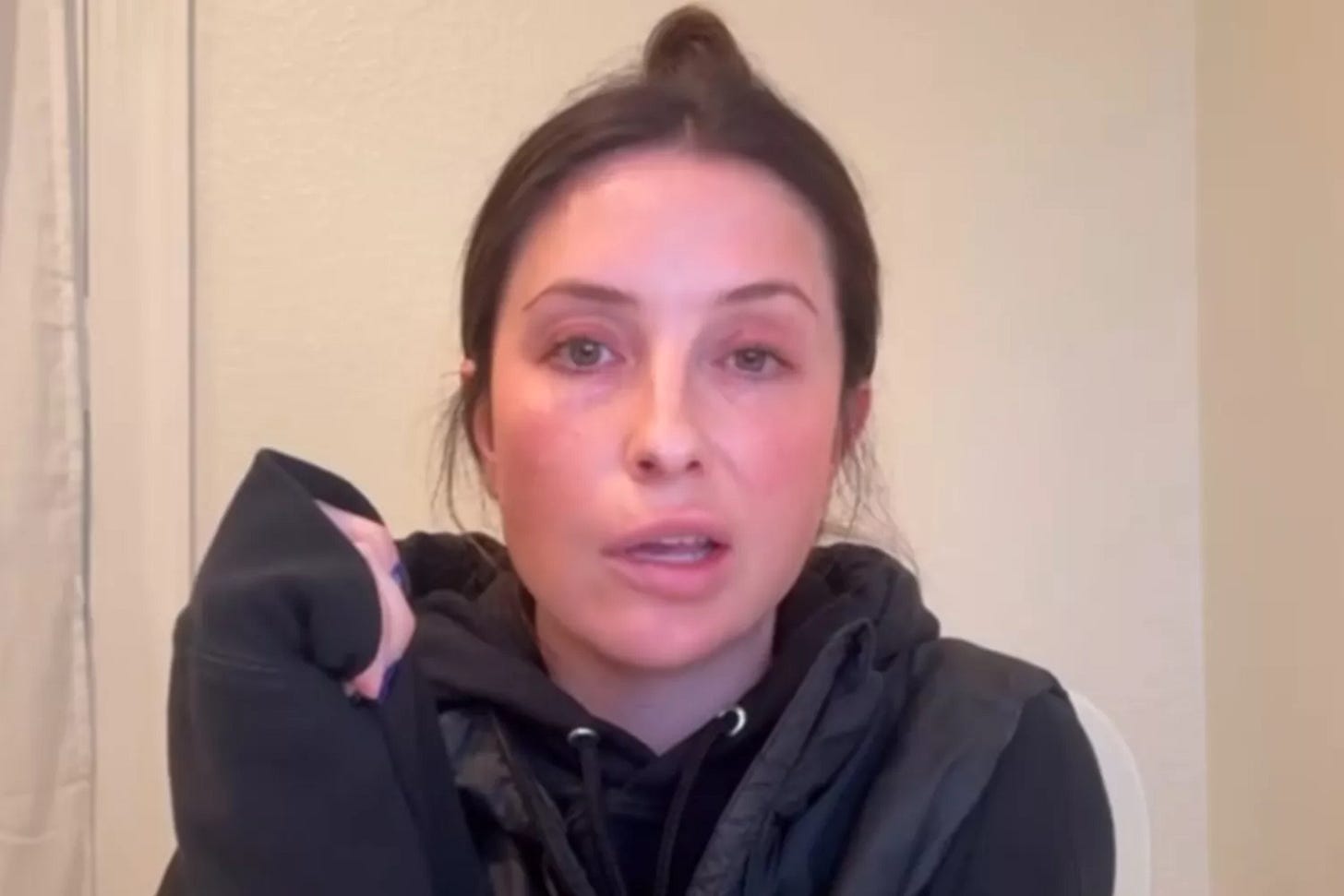 Bristol Palin Reveals Facial Paralysis