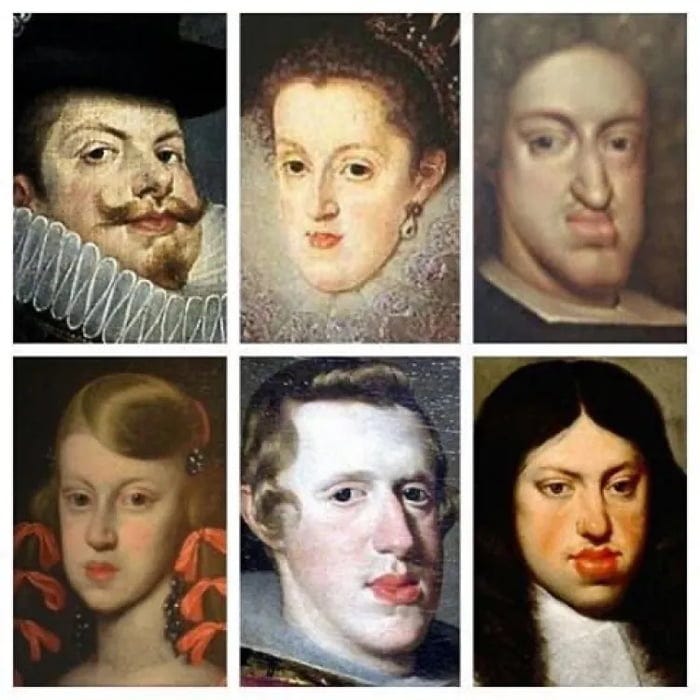 The Habsburg Jaw. Hunderds of years of good ol' inbreeding. Beauties, ain't they? - 9GAG