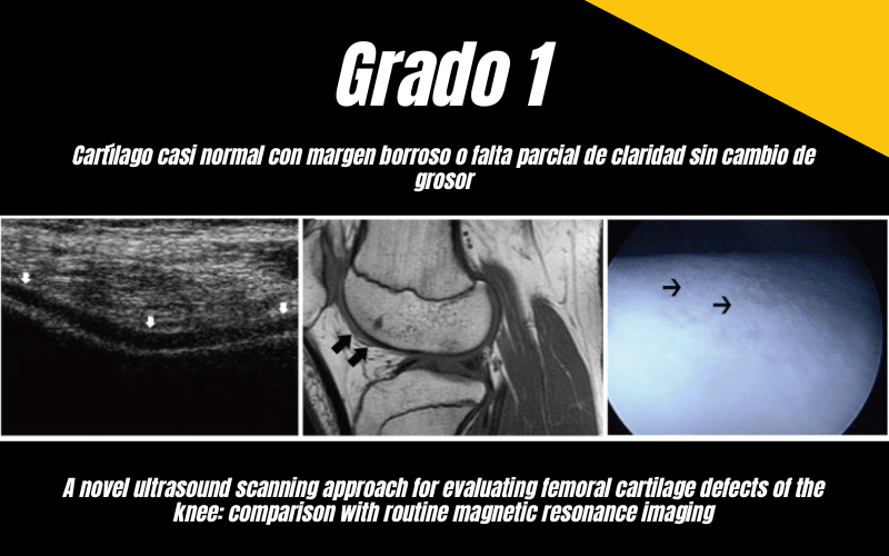 4. Ecografia Tempo formacion Cartilago Femoral.png