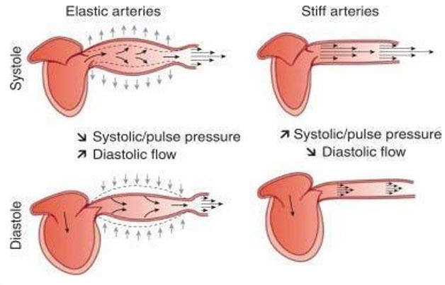 arteries