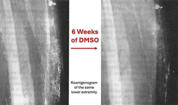 dmso six weeks