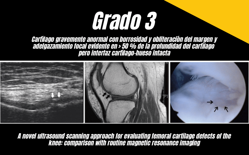 6. Ecografia Tempo formacion Cartilago Femoral.png