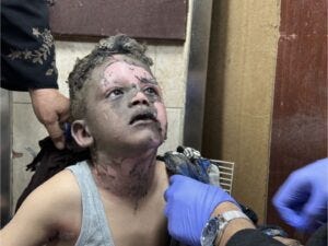 A child injured in the Israeli attack on Nuseirat refugee camp
