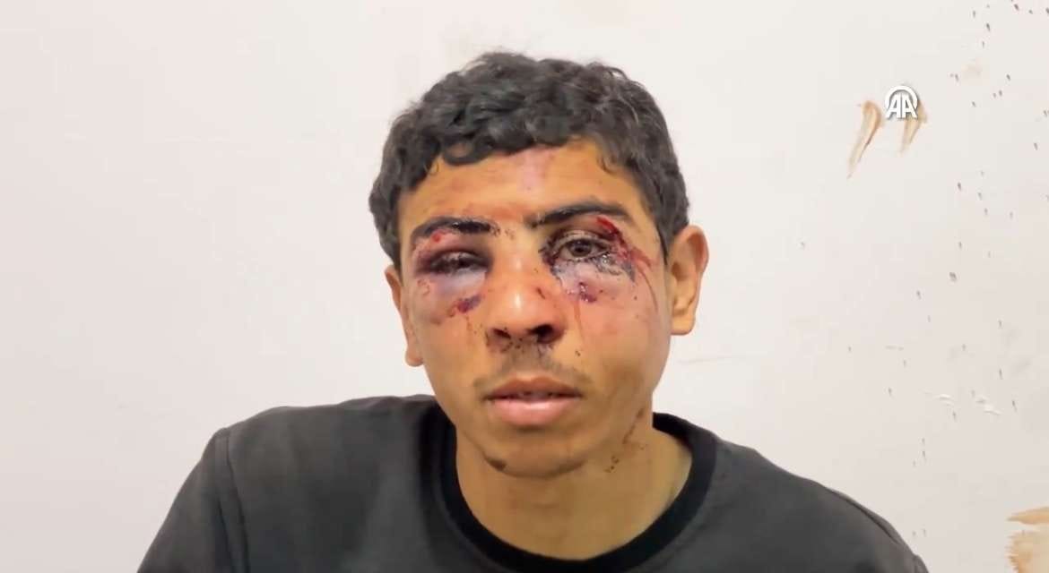 Horrific testimonies: Israeli army tortures Palestinians in Gaza physically and psychologically