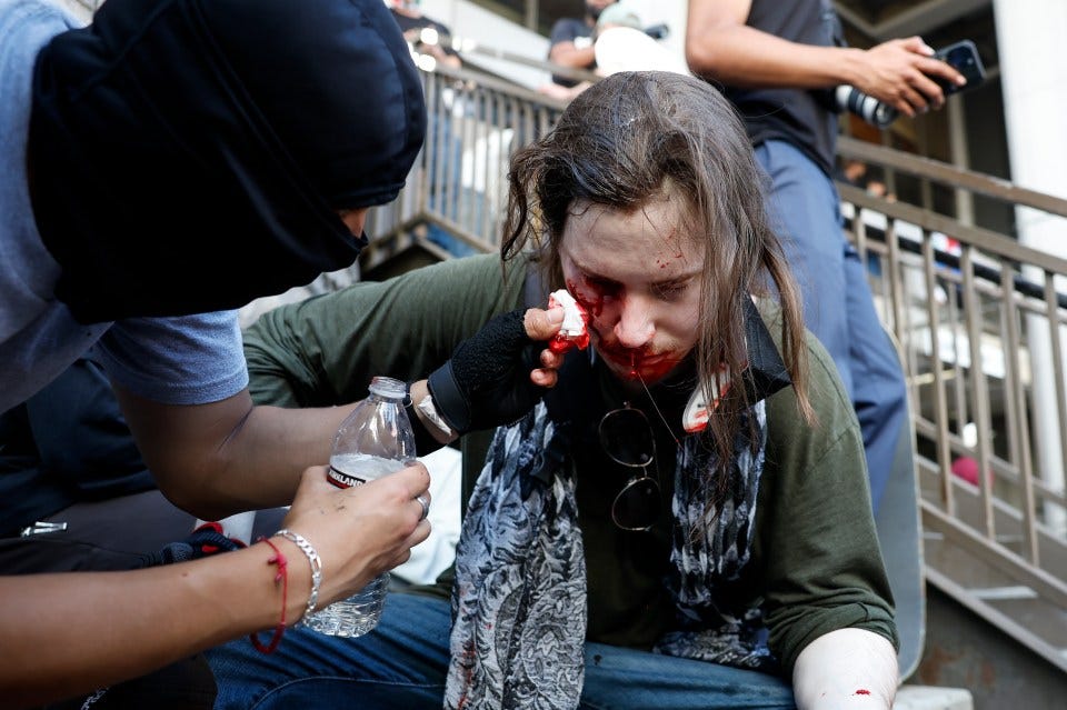 A protester with a bloody face wound being treated by another person.