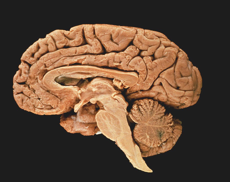 Section Through A Human Brain Photograph by Science Pictures Limited ...
