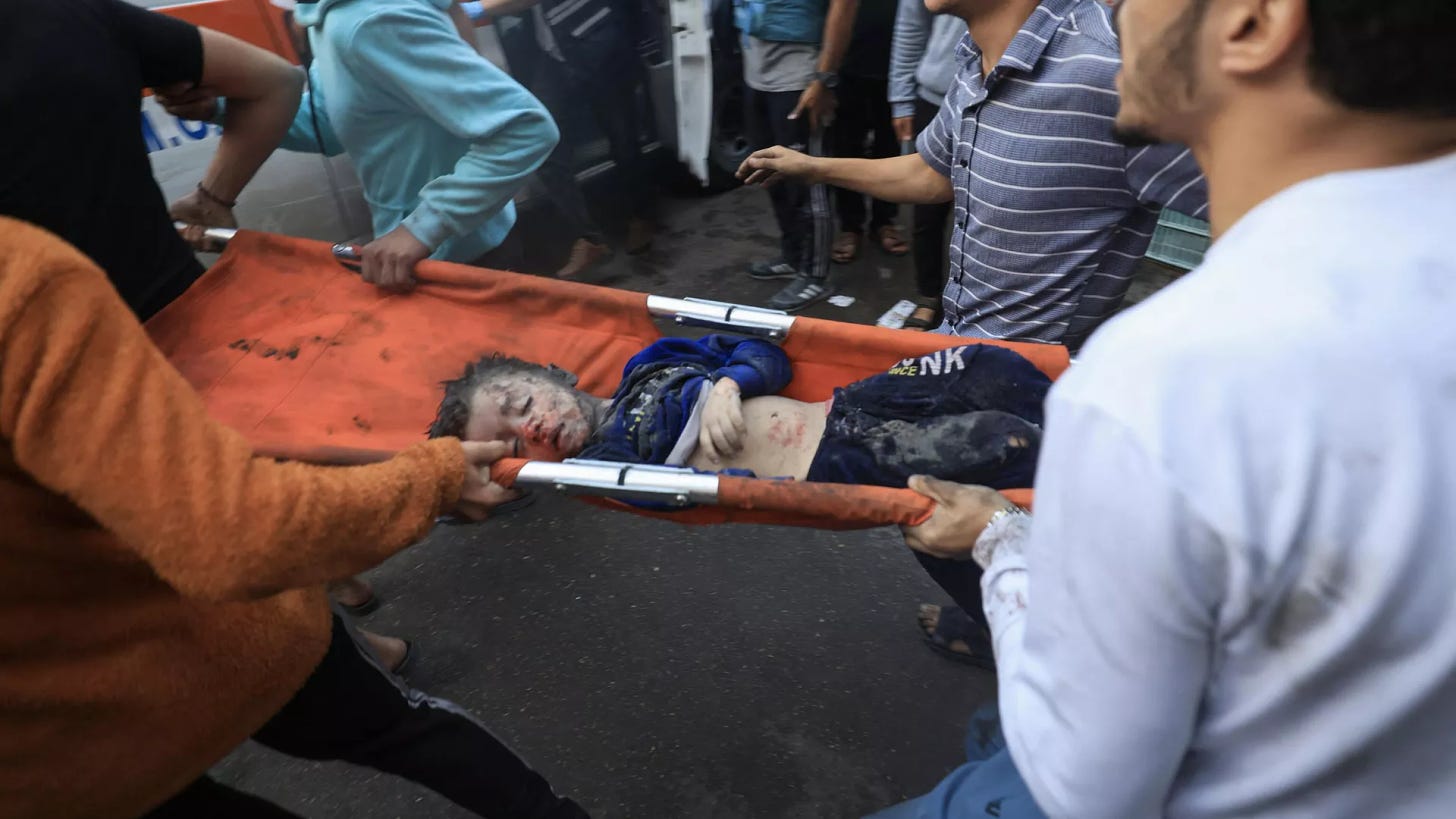 Palesztin fiú megsebesült egy izraeli bombázás következtében – RIA Novosti, 1920, 2023.11.18.