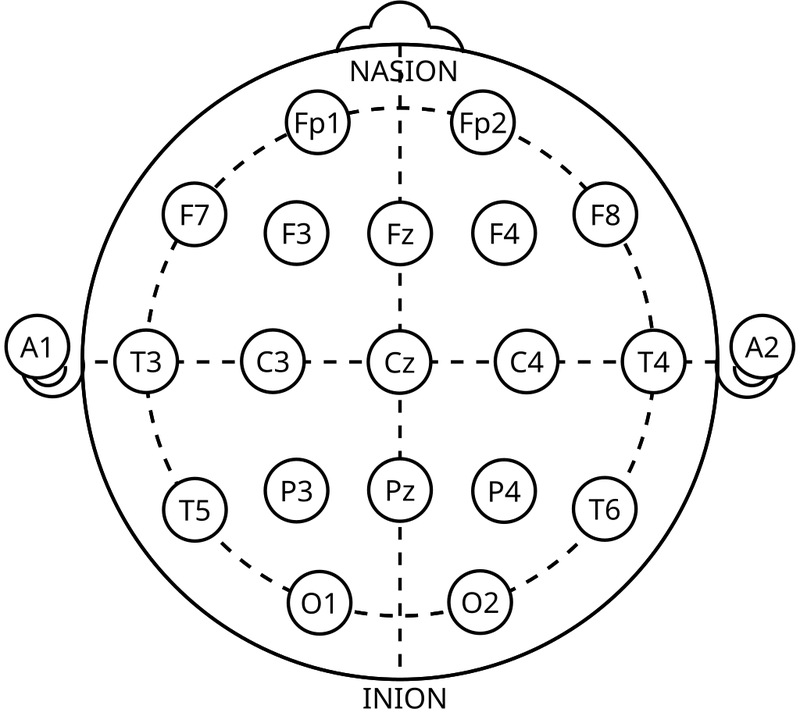 https://image.lichess1.org/display?h=0&op=resize&path=ndpatzer:ublogBody:XYKuGkBmfWUG:9JeHQjM9.png&w=800&sig=49eecd9475a78d5ba68258324ba5c0504154b57b