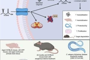 B-hydroxybutyrate is a metabolic regulator of proteostasis in the aged and Alzheimer’s disease brain