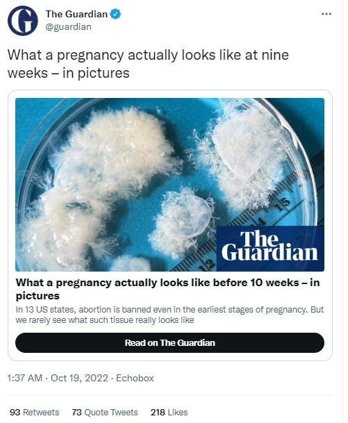 fetal tissue from the Guardian