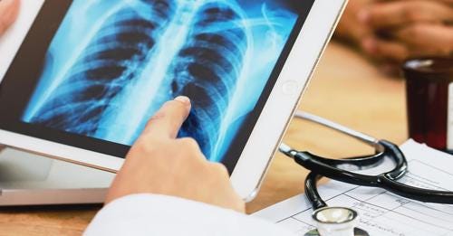 New study finds alarming rise in cancer rates among people under 50