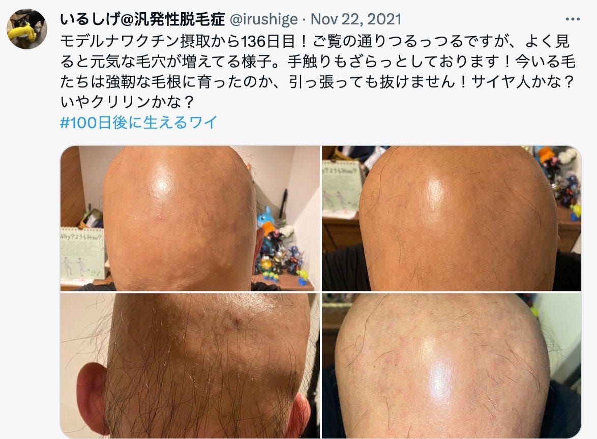 136th day after vaccination. (irushige/Twitter)
