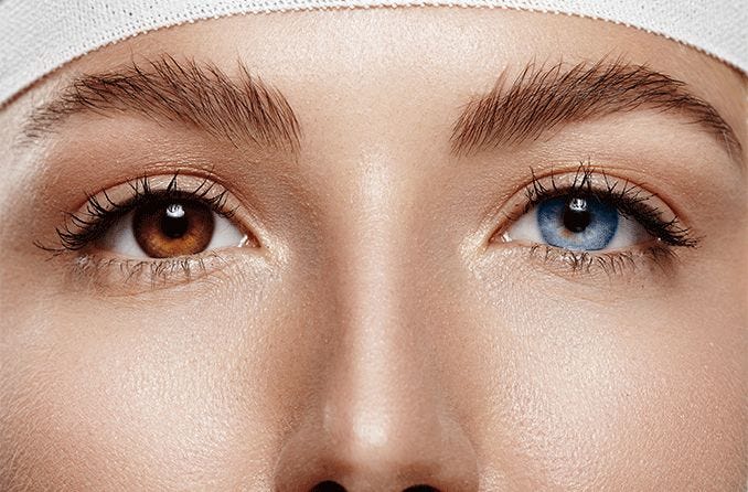 Eye Color Change Surgery - All About Vision