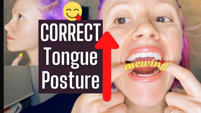 Mewing - How to Achieve Correct Tongue Posture: Placement, Back 1/3, Push  on Palate