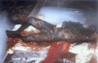Charred body of a Godhra victim