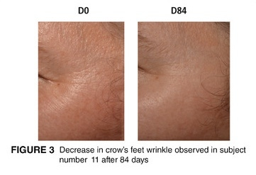 Wrinkle comparison